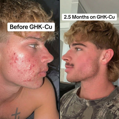 GHK-Cu Copper Peptide Serum
